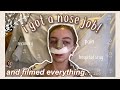 I GOT A NOSE JOB! Hospital Stay & Recovery | Rhinoplasty Vlog 2021