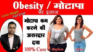 मोटापा का इलाज | How to Lose Weight | Motapa kam Karne Ke Upay | Weight Loss Treatment & Medicine