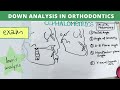 downs analysis orthodontics - dental lectures