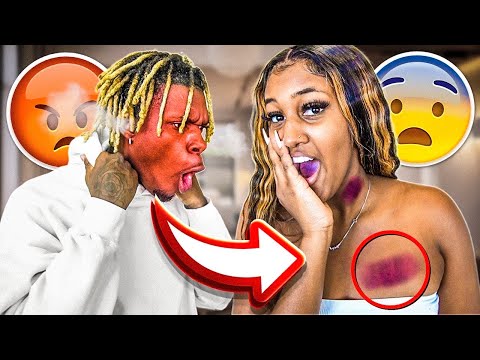 hickey-prank-on-king!!!😱