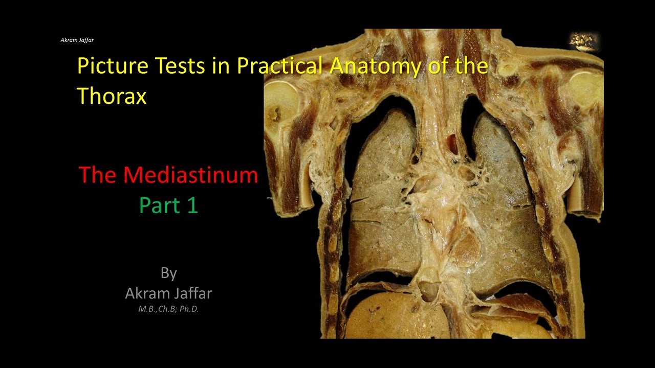 Picture Tests in Anatomy - Thorax - Mediastinum 1 + Anki flashcards