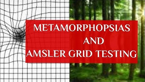 METAMORPHOPSIAS and AMSLERS GRID TESTING