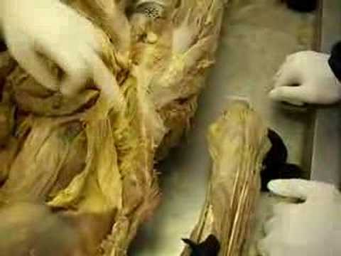 Anatomy - Skeletal Muscles Part 3 - YouTube