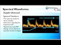 Doppler Principles - Spectral Analysis