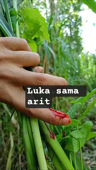 Tangan terkena sabit #ngaret #cow #sapigemuk #sapi #sapilucu #sapijumbo #sapimakan #automobile