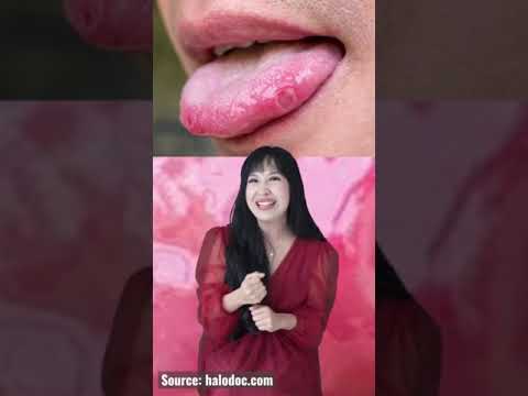 Video: Siapa yang menyebarkan iklan dari mulut ke mulut?