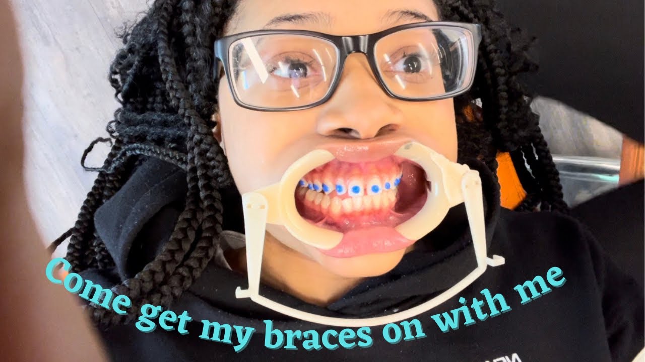 Vlog: come get my braces on with me , first time