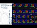 Nuclear Cardiology: Understanding the Basics (John J. Mahmarian, MD) October 16, 2018