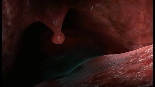 Whale eats Dory and Marlin (Finding Nemo) Whale eats Dory and Marlin (Finding Nemo)
