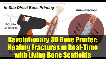 Revolutionary 3D Bone Printer: Healing Fractures in Real-Time with Living Bone Scaffolds