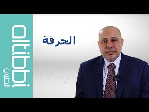 ما هو علاج الحرقة