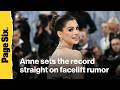 Anne Hathaway finally sets the record straight on 'loud' facelift speculation