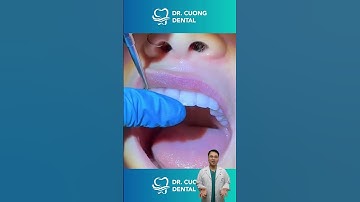 Sự biến đổi của hàm răng sắt | Bác sĩ Cường