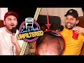 Heath's Drink Caused This Reaction - UNFILTERED #20