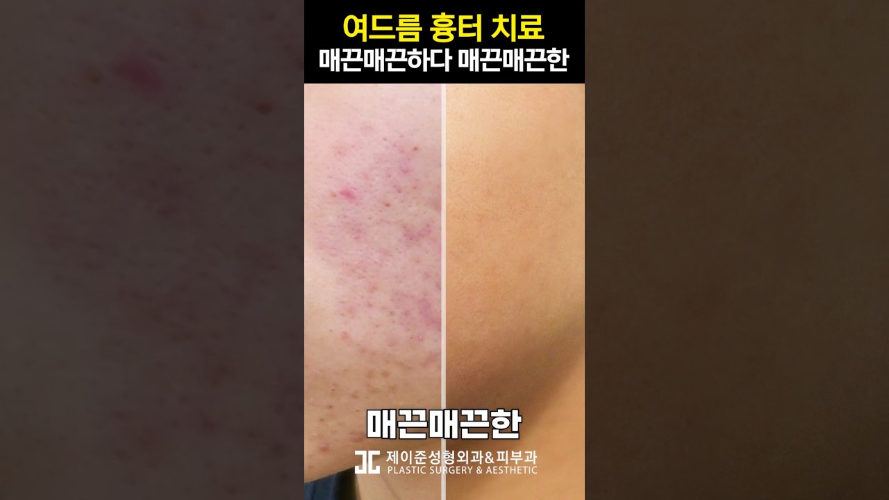 THẨM MỸ VIỆN & DA LIỄU JAYJUN ✨Mịn màng, mịn màng~🎵 Thử thách da mịn màng #shorts #mịn_màng #mịn_màng #bài_hát_cấm_thời_thi_đại_học