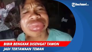 Ngakak! Bibir Bengkak Disengat Tawon Jadi Tertawaan Teman