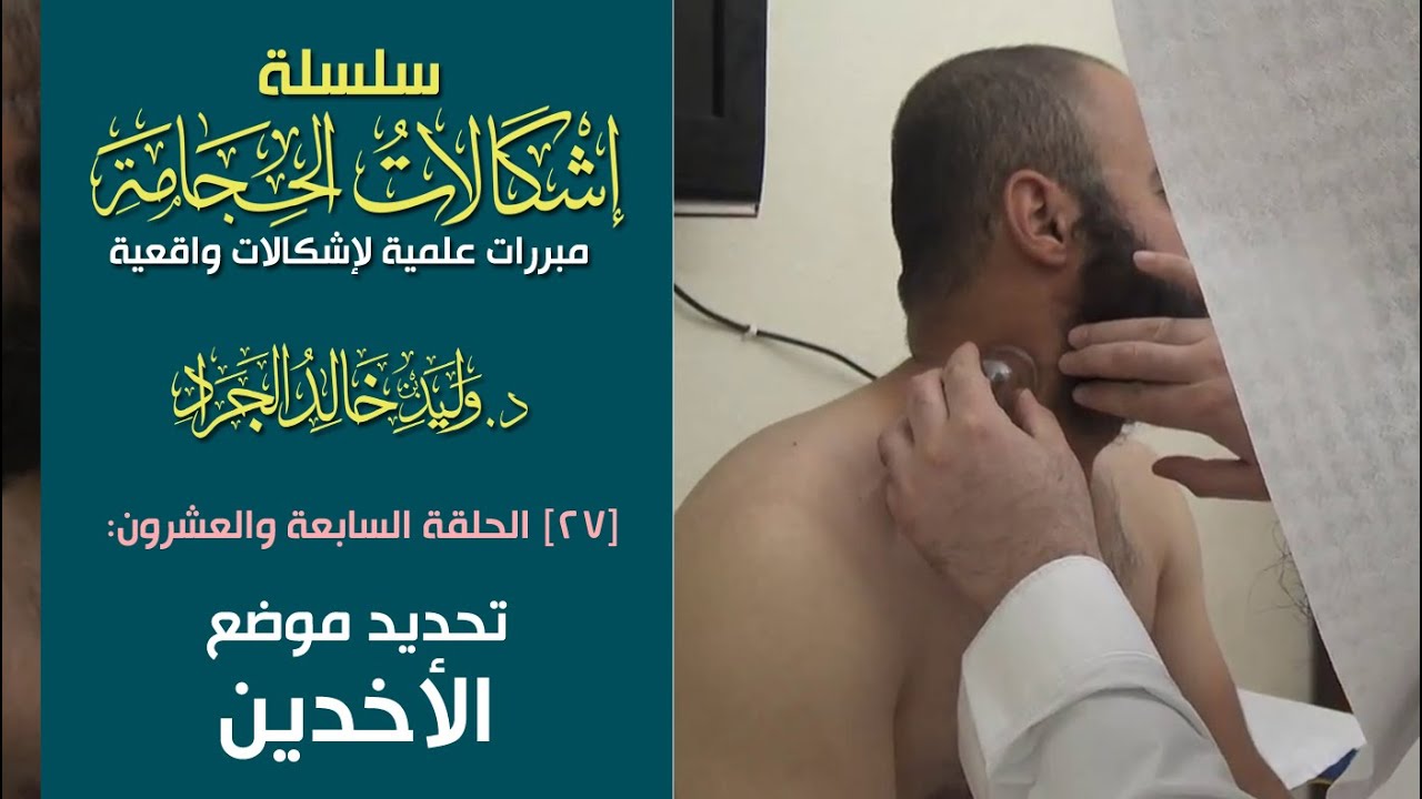 #سلسلة_إشكالات_الحجامة [27] تحديد موضع الأخدين