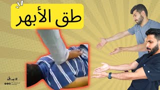 بديل 2 | طق الأبهر