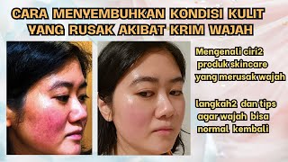 CARA MENYEMBUHKAN KULIT YANG RUSAK AKIBAT KRIM WAJAH