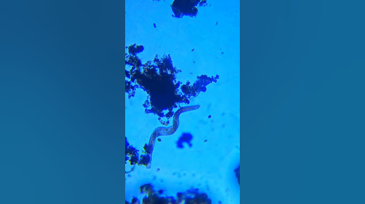 Testing water filter results under a microscope 🔬