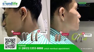 Apa Perbedaan Antara Alat Bantu Dengar Behind-The-Ear Bte Dan Receiver-In-Ear Rie?