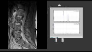 fMRI data analysis
