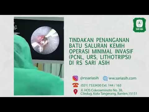 Rumah Sakit Sari Asih (Tindakan Penanganan Batu Saluran Kemih Operasi Minimal Invasif)