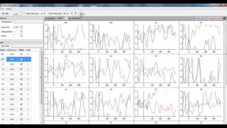 NeuroGuide Auditory P300