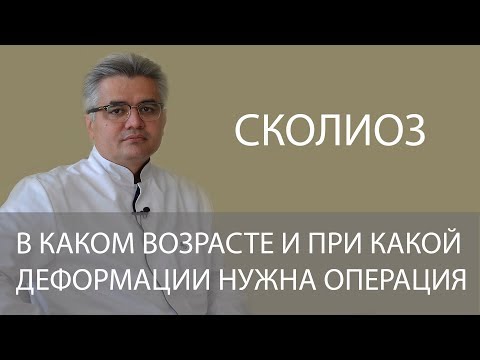 В каком возрасте и при какой деформации нужно лечить сколиоз оперативно?