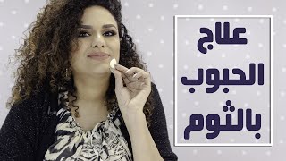 علاج الحبوب بالثوم