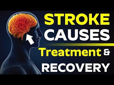 What is Brain Stroke? || Stroke Causes, Symptoms and Treatment Options