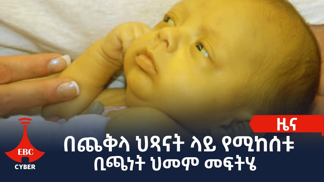 በጨቅላ ህጻናት ላይ የሚከሰቱ ቢጫነት ህመም መፍትሄ Etv | Ethiopia | News
