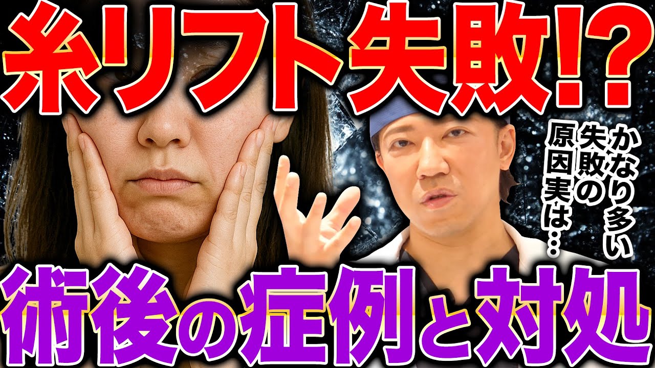 【糸リフト失敗例】顔が四角くなる、頬のボコつき、顔が大きくなる…実は明確な失敗の原因があるんです。