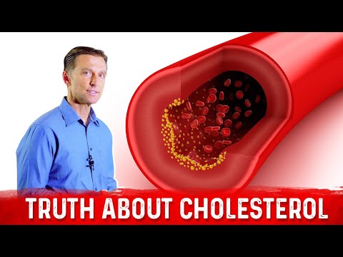 The Truth About Cholesterol - and LDL and HDL