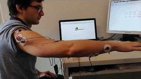 EMG simulation in MATLAB