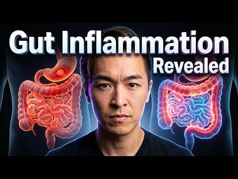 Leaky Gut, Gut Inflammation, and Root Cause Healing — What Your Doctor Never Told You. pt 1