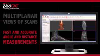 Curve Beam Pedcat Overview