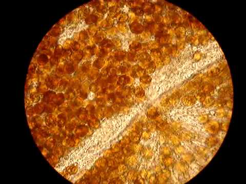 Zooxanthellen Unter Dem Mikroskop Youtube