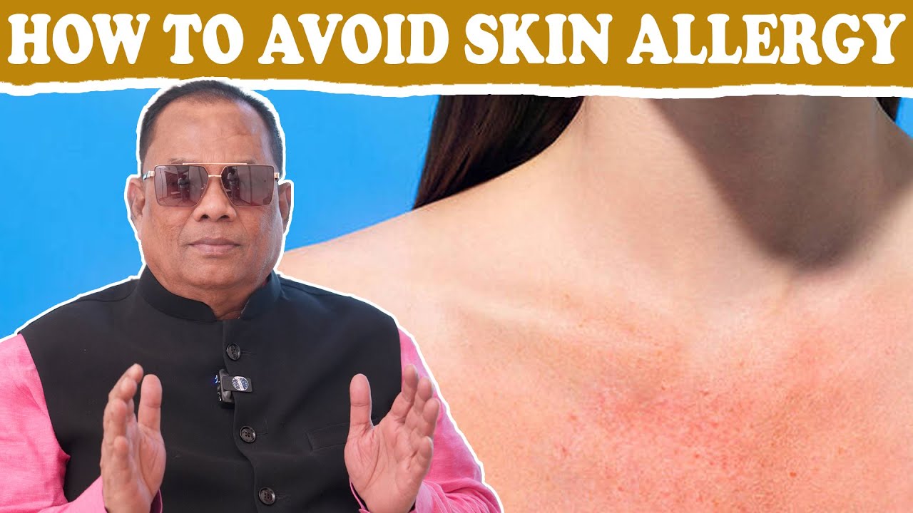 HOW TO AVOID SKIN ALLERGY / CKN