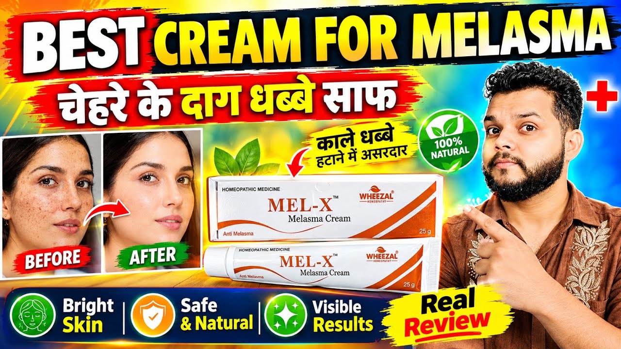 Crème Wheezal Mel-X Pour Mélasma Peau - 25 G - Sans Cruauté Animale - Expiration Longue