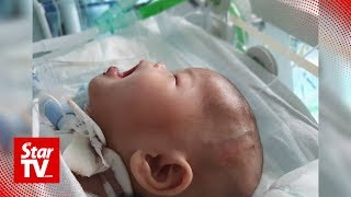 Little Ainul Mardhiah Successfully Operated On In London