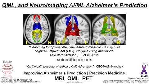 QML, and Neuroimaging AI/ML Alzheimer