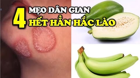 Bệnh Hắc Lào Hết Hẳn nhờ 4 CÁCH CHỮA ĐƠN GIẢN tại nhà | Cuộc Sống Hạnh Phúc