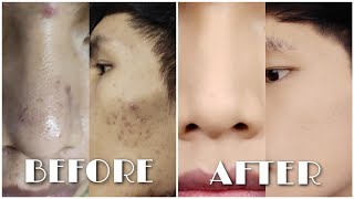Pores leh hmai bawl na hnu duk makeup hmang a hliahkhuh dan || Mizo Makeup Tutorial || Franky Fanai