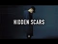 Capture de la vidéo [Free] Hard Nf Type Beat - "Hidden Scars"