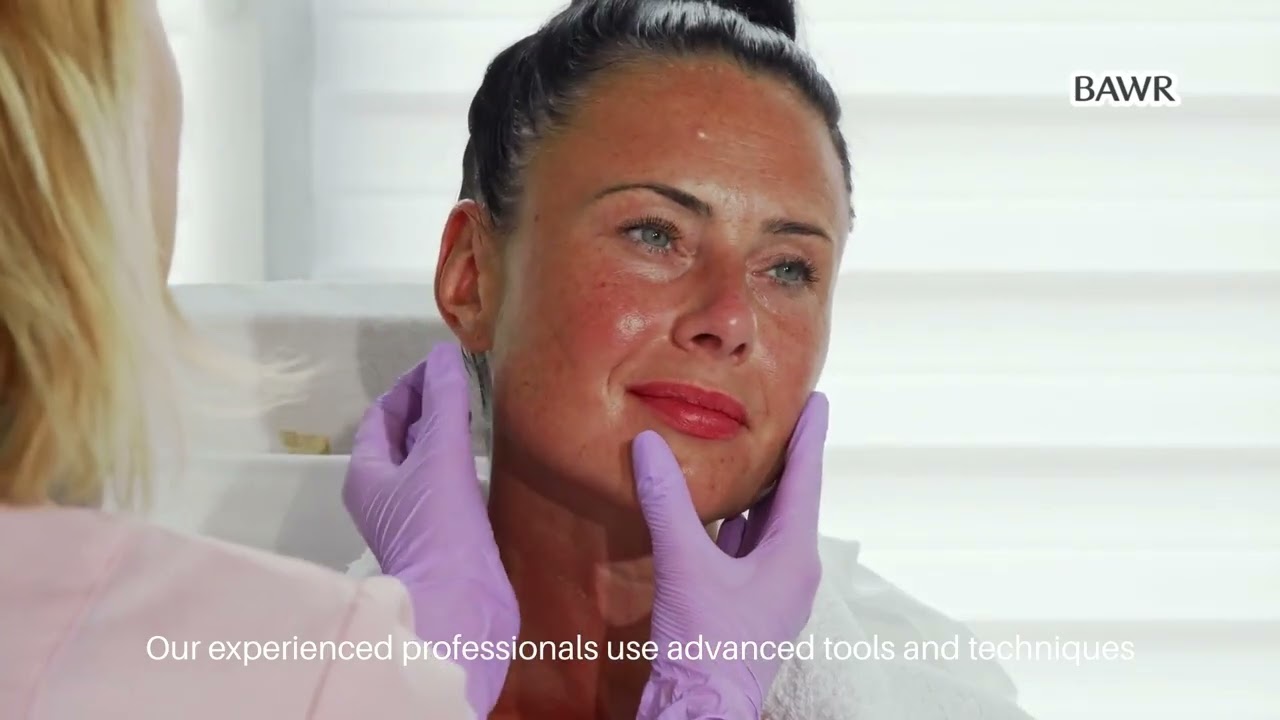 ✨ Flawless Skin Made Easy: Best Microneedling in 