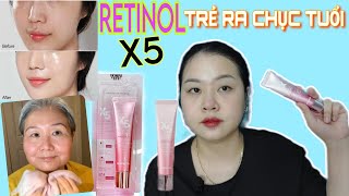 PREVIEW CHÂN THẬT KEM RETINOL X5 SAU 2 THÁNG SỬ DỤNG