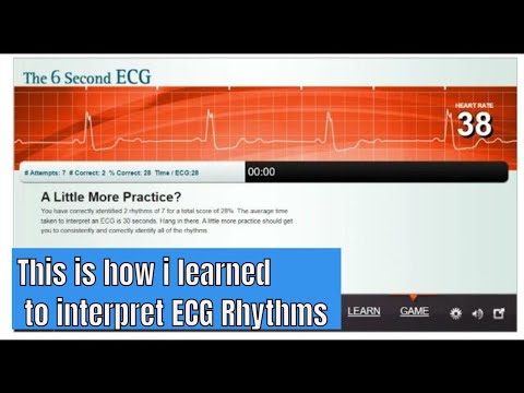 Learn to #interpret #ECG rhythm with the #game