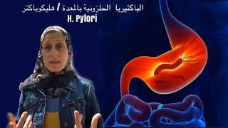 الباكتريا الحلزونيه - الهليكوباكتر بالمعده- H.pylori