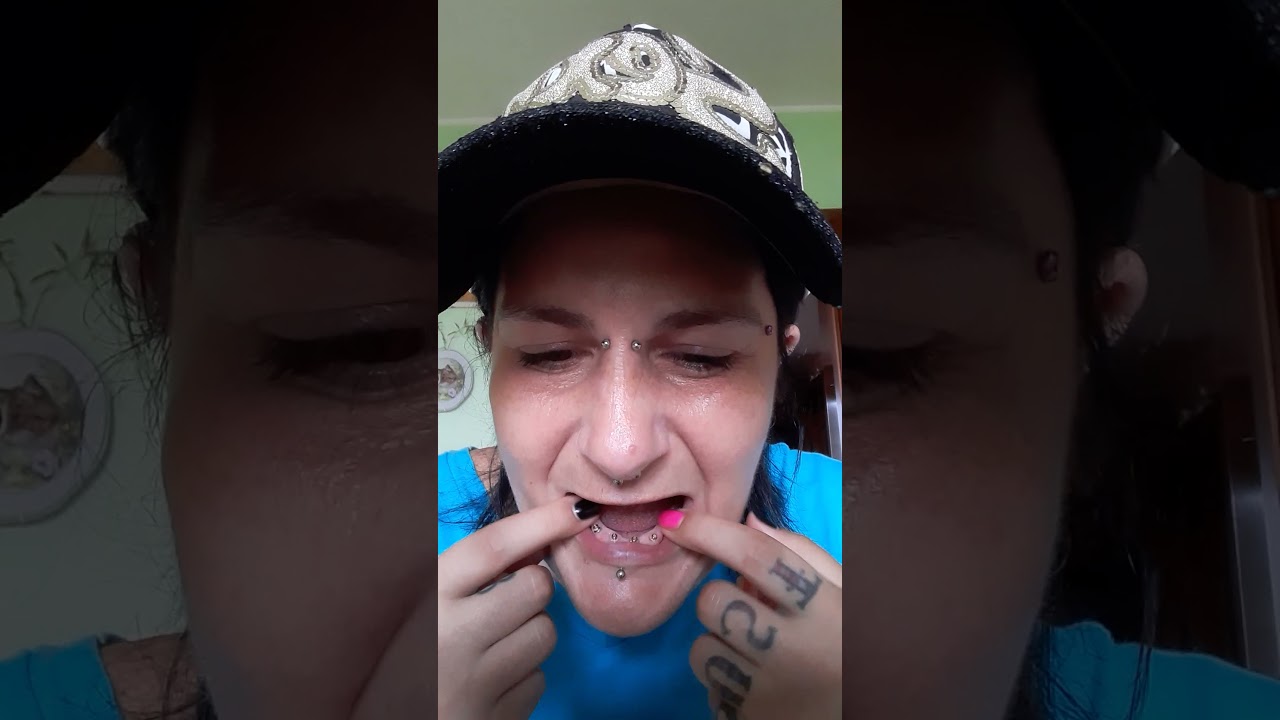 IO E LA MIA DENTIERA 🦷🦷🦷🦷DENTIERA🦷🦷🦷🦷